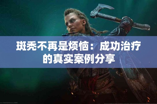 斑秃不再是烦恼：成功治疗的真实案例分享