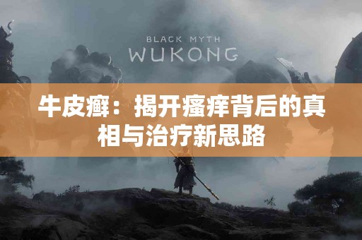 牛皮癣：揭开瘙痒背后的真相与治疗新思路